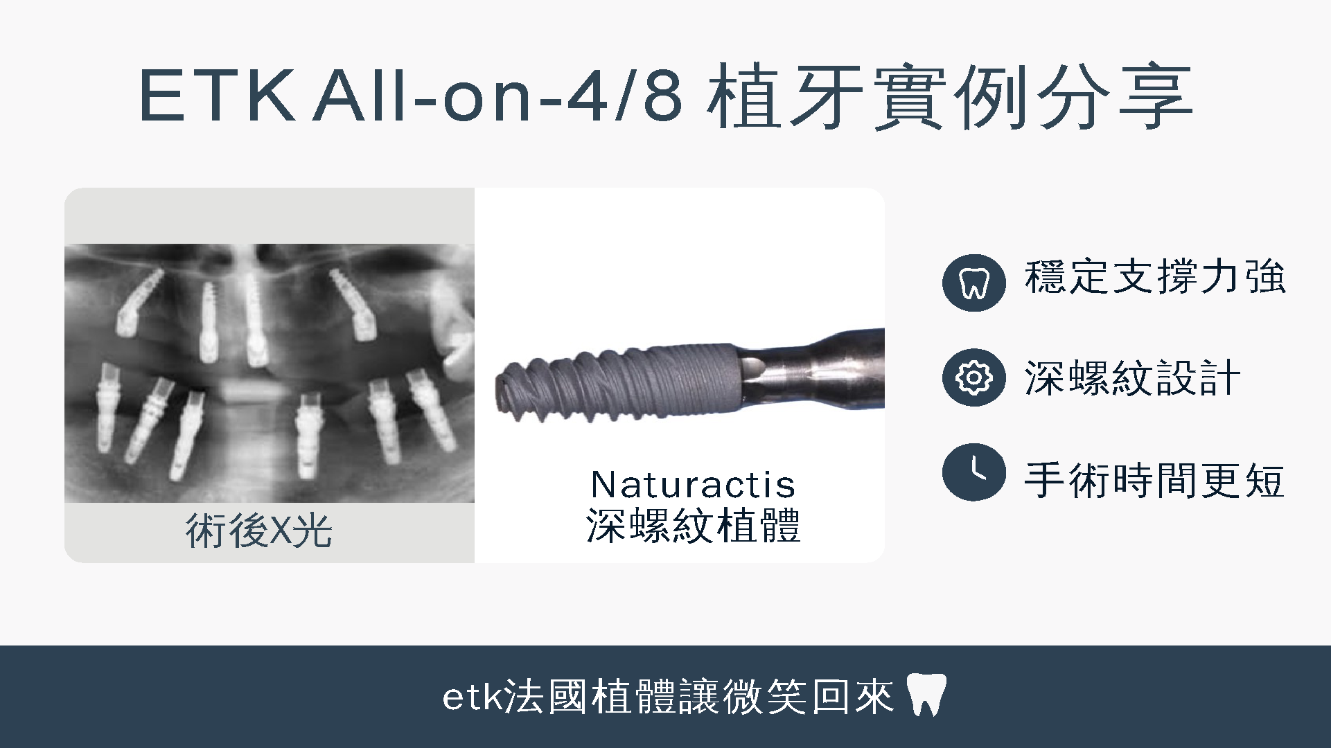 all-on-4-case